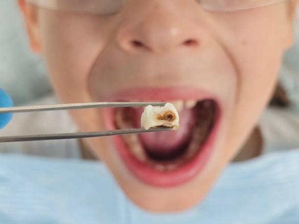 Best Urgent Tooth Repair  in Montebello, NY